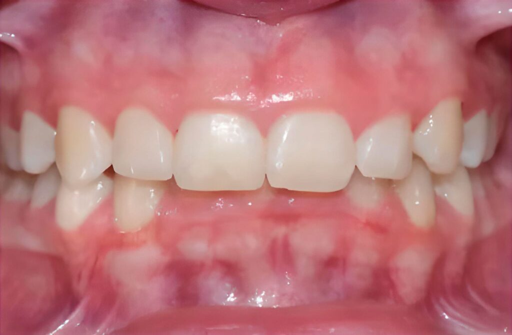 Cirurgia oral 1 cirurgia-oral-antes-2
