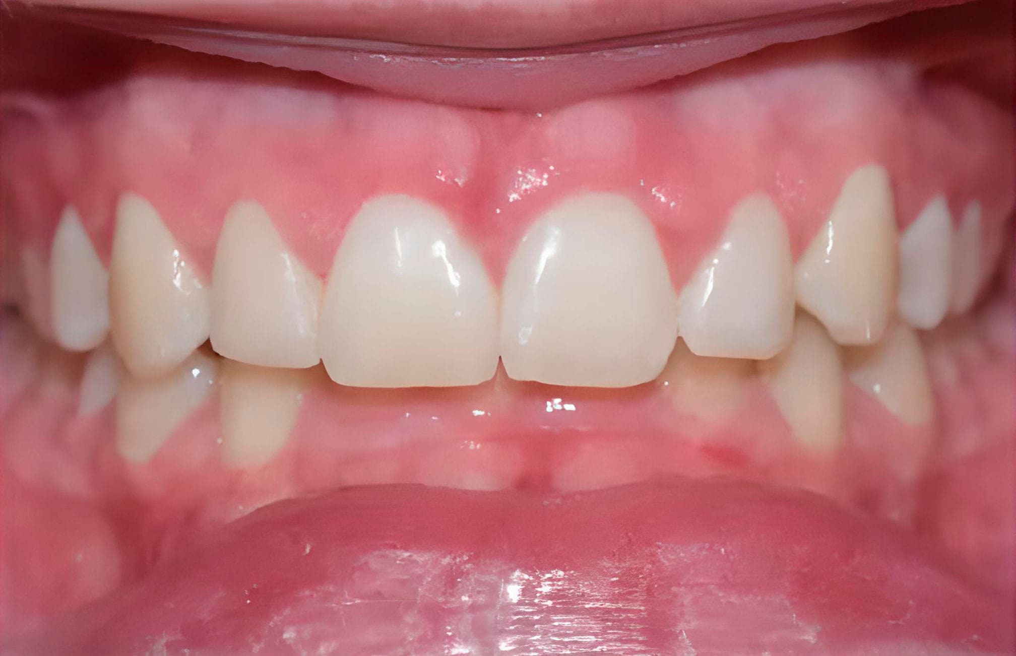 Cirurgia Oral em Curitiba - Lidery Odontologia