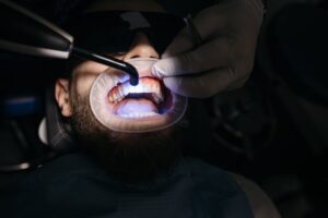 Dentista realizando restauração dental com luz ultravioleta em paciente