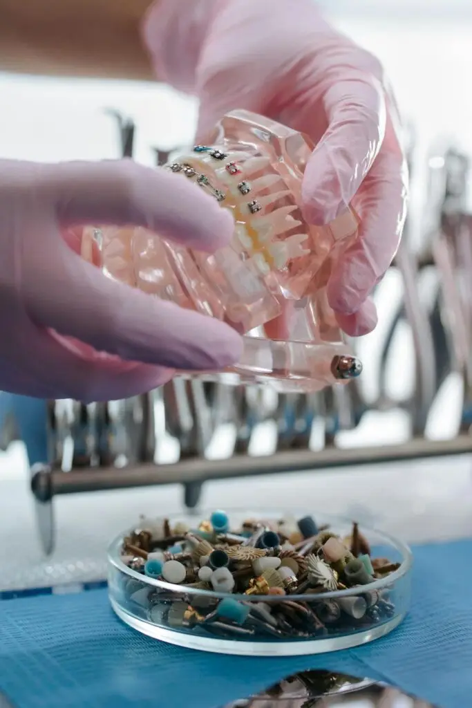 Modelo de prótese dental para tratamento de dente escurecido