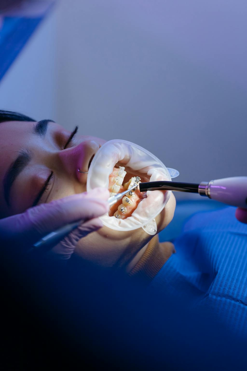 Paciente em tratamento periodontal em clínica odontológica moderna