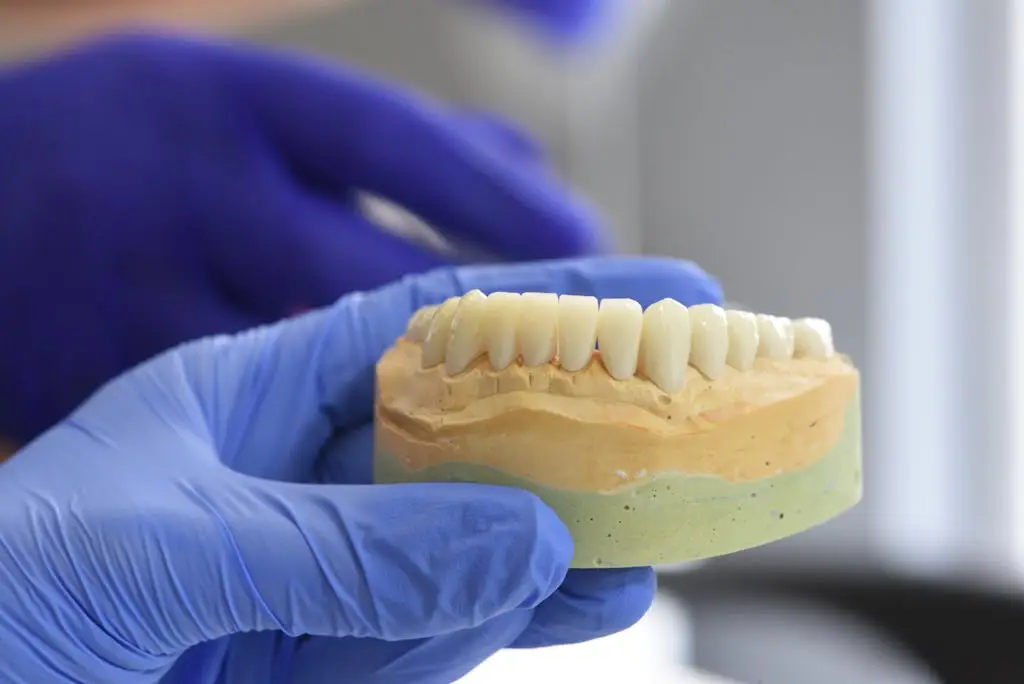 Modelo dental de implante com carga imediata em mãos do dentista