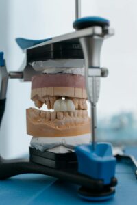 Modelo de prótese protocolo sobre implantes em equipamento dental