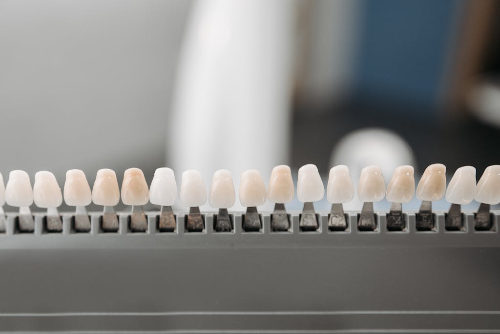 Resultado estético de restauração dental em resina composta
