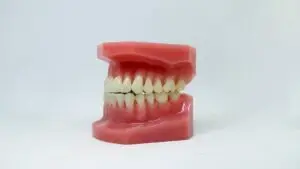 Modelo dental representando conexão entre saúde bucal e cardíaca
