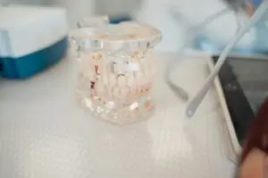 Modelo dental demonstrando cuidados bucais na terceira idade
